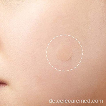 Entfernen von Blemish Patch verfügbares Hydrocolloid -Akne -Entfernungsfleck